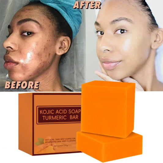 100G Kojic Acid Soap Facial Cleaning